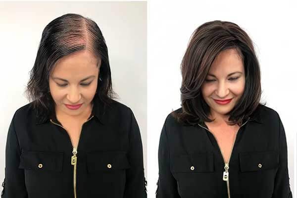 Antes e depois da irmã da Sarah usando Growy