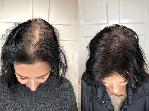 Resultado Growy - volume